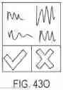 Fig. 103 - DEVICES METHODS AND SYSTEMS FOR WIRELESS CONTROL OF MEDICAL DEVICES