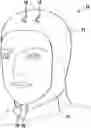 Fig. 01 - Device and method for determining sleep apnea