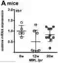 Fig. 01 - METHOD FOR DETECTING LUPUS NEPHRITIS