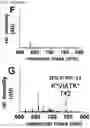 Fig. 03 - METHOD FOR DETECTING LUPUS NEPHRITIS