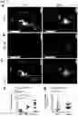 Fig. 10 - METHOD FOR DETECTING LUPUS NEPHRITIS