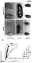 Fig. 12 - METHOD FOR DETECTING LUPUS NEPHRITIS
