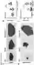 Fig. 13 - METHOD FOR DETECTING LUPUS NEPHRITIS
