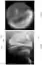 Fig. 07 - Method and apparatus for Schottky TFE inspection