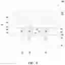 Fig. 08 - Methods for reducing dual damascene distortion