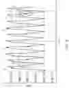 Fig. 04 - Parasitic pulse cancelation circuit
