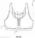 Fig. 05 - Breast separator devices