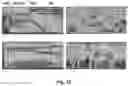 Fig. 11 - Systems and methods for analyzing brain activity and applications thereof