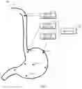 Fig. 06 - Method, apparatus, device and computer storage medium for a medical assistance operation