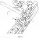 Fig. 02 - Snowmobile assistant device