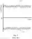 Fig. 04 - DIFFERENTIAL HYDRAULIC BUFFER