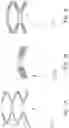 Fig. 08 - DIFFERENTIAL HYDRAULIC BUFFER