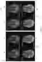 Fig. 07 - Deep learning based medical system and method for image acquisition