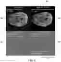Fig. 08 - Deep learning based medical system and method for image acquisition