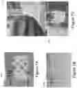 Fig. 08 - VASCULAR CASTING AND APPLICATIONS THEREOF