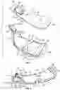 Fig. 02 - Traction system for an ambulatory support