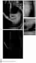 Fig. 07 - GENE THERAPY TARGETING COCHLEAR CELLS