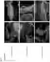 Fig. 09 - GENE THERAPY TARGETING COCHLEAR CELLS