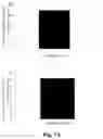 Fig. 09 - MESENCHYMAL STEM CELLS-HYDROGEL-BIODEGRADABLE OR MESENCHYMAL STEM CELLS-HYDROGEL-NONDEGRADABLE SUPPORT COMPOSITION FOR ALLEVIATING OR IMPROVING EPIDERMOLYSIS BULLOSA