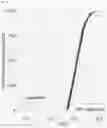 Fig. 36 - PROSTATE CANCER DETECTION METHODS