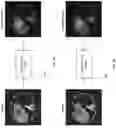 Fig. 08 - GENERATING PSEUDO LESION MASKS FROM BOUNDING BOX ANNOTATIONS