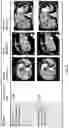 Fig. 09 - GENERATING PSEUDO LESION MASKS FROM BOUNDING BOX ANNOTATIONS