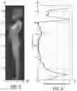 Fig. 03 - Radiological imaging method