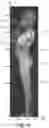 Fig. 09 - Radiological imaging method