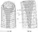 Fig. 09 - ANTI-LOCKING THROMBECTOMY APPARATUSES AND METHODS