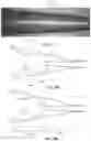 Fig. 18 - ANTI-LOCKING THROMBECTOMY APPARATUSES AND METHODS