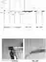Fig. 20 - ANTI-LOCKING THROMBECTOMY APPARATUSES AND METHODS