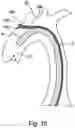 Fig. 07 - Embolic Protection Device And Method