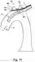 Fig. 08 - Embolic Protection Device And Method