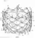 Fig. 02 - PROSTHETIC HEART VALVE