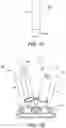 Fig. 06 - Joint replacement prosthesis with trans-cortical stems