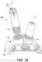 Fig. 08 - Joint replacement prosthesis with trans-cortical stems