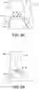 Fig. 09 - Joint replacement prosthesis with trans-cortical stems