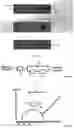 Fig. 02 - ARTIFICIAL KIDNEY SYSTEM AND DEVICE