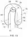 Fig. 08 - Urinary catheter