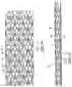 Fig. 03 - Intravascular stent having high fatigue performance