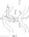 Fig. 05 - Intravascular stent having high fatigue performance