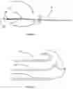 Fig. 03 - DRUG ELUTING GUIDE WIRE