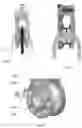 Fig. 11 - Pulley