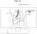Fig. 10 - Medical image processing apparatus and medical image processing method