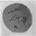 Fig. 01 - Breast calcification imaging phantoms and methods of use