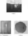 Fig. 02 - Breast calcification imaging phantoms and methods of use