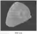 Fig. 04 - Breast calcification imaging phantoms and methods of use