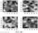 Fig. 05 - Breast calcification imaging phantoms and methods of use