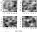 Fig. 08 - Breast calcification imaging phantoms and methods of use