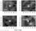Fig. 09 - Breast calcification imaging phantoms and methods of use